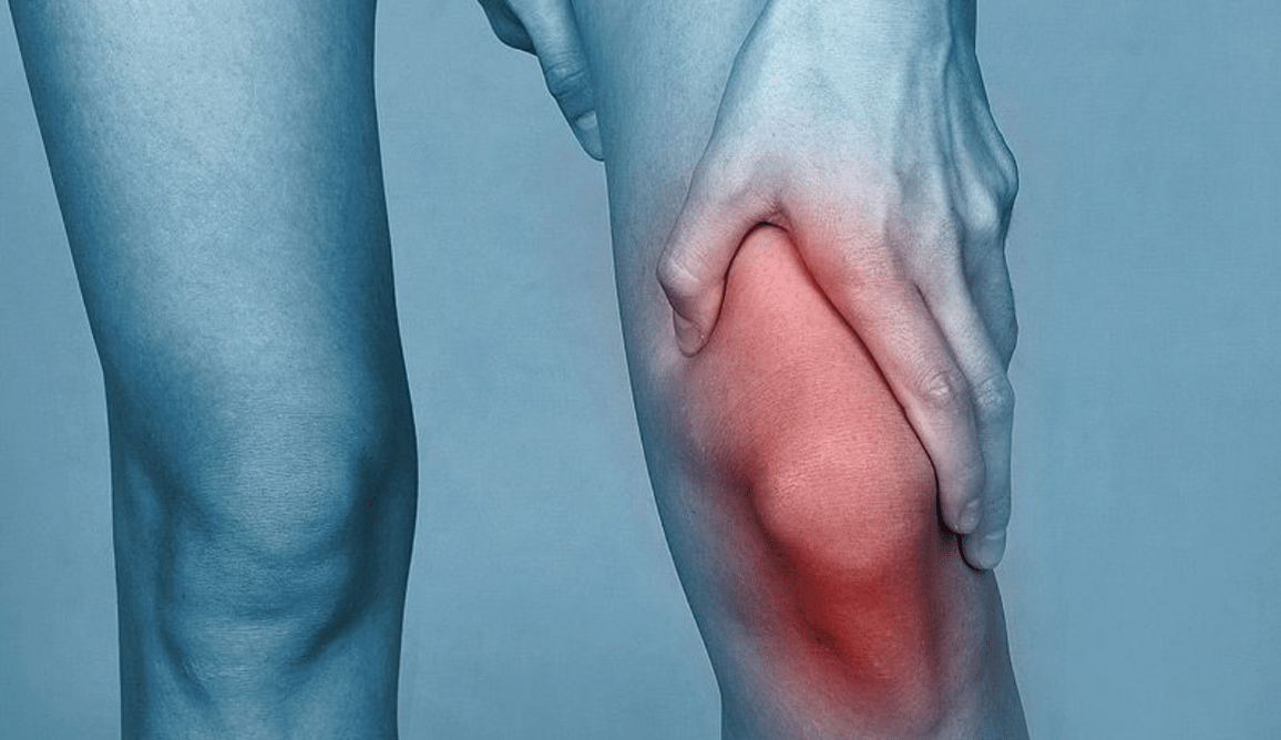 Kniegelenkschmerzen aufgrund von Arthrose